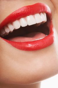 סוגי הלבנות שיניים